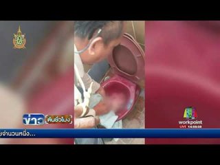 ตร จับสาว 18 คลอดลูกทิ้งปั๊ม | ข่าวต้นชั่วโมง |  26 ก.ค. 59