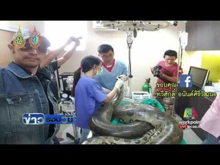อนาคอนด้า ตายแล้วหลังผ่าตัดเนื้องอก | ข่าวรอบวัน | 26 ส.ค. 59