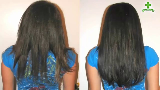 How To Grow Hair Fast | Hair Treatment For Natural Hair Growth