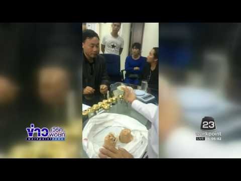 ด่านแม่สายยึดทอง 19 ก้อนน้ำหนักกว่า 10 กิโลกรัม l ข่าวเวิร์คพอยท์ (เที่ยง) l 11 ม.ค 60