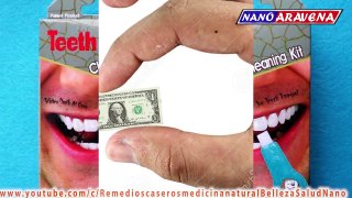 4 Tips caseros para eliminar el sarro de los dientes. Remedio Casero y natural