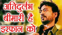 Irrfan Khan suffering from rare disease, only 5 in 1 lakh people have this problem | FilmiBeat