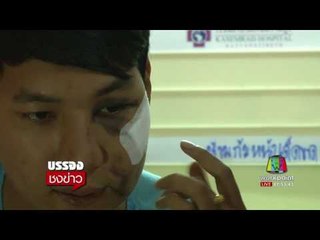 คู่กรณีแท็กซี่เหล็กฟาด ขอจบชั้นไกล่เกลี่่ย ถ้าแท็กซี่ร่วมจ่ายค่ารักษา | บรรจงชงข่าว | 4 ส.ค. 60