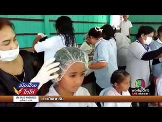 เร่งปราบเหาในเด็ก หลังพบว่าทำให้ขาดสมาธิ | เมืองไทยไก่โห่ | 1 ก.ย. 60