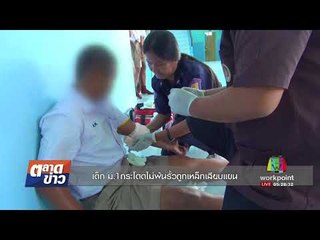 เด็ก ม.1กระโดดไม่พ้นรั้วถูกเหล็กเสียบแขน l ตลาดข่าว l 28 ก.ย. 60