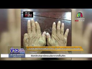 รวบหัวหน้ายากูซ่าหนีซุกไทย โดนจับเพราะชอบโชว์ลายสัก l ข่าวเวิร์คพอยท์ (เช้า) l 11 ม.ค.61