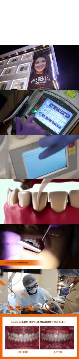 LASER DENTISTRY IN HYDERABAD INDIA - FMS DENTAL HOSPITALS