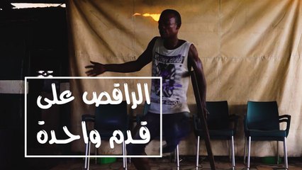 فقدت ساقي وأصبحت مدرب رقص