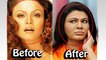 [MP4 1080p] 8 Bollywood Actress Plastic Surgery Gone Wrong _ Then and Now