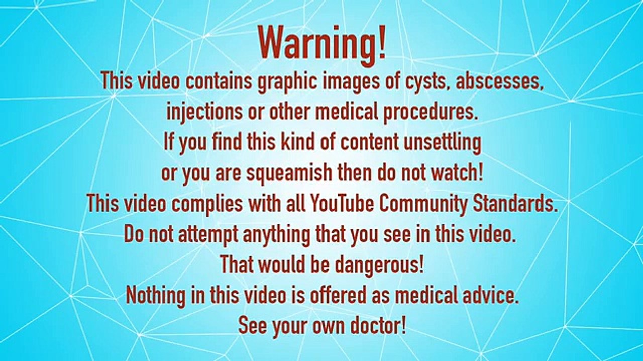 Fishbone Back Cyst Excision, Gonzo & Gumby Interview