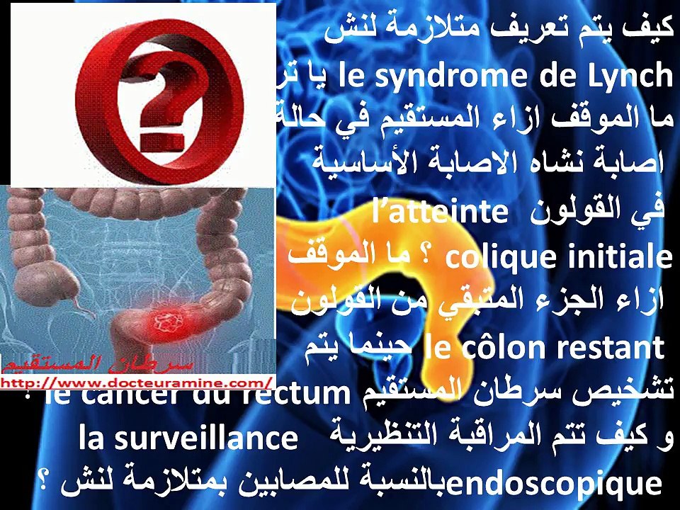 Le cancer du rectum, cancer colorectal سرطان المستقيم ، سرطان القولون و لمستقيم
