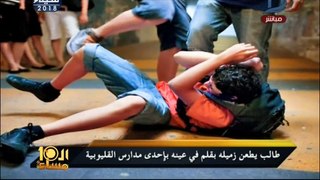 العاشرة مساء| تلميذ يفقأ عين زميله داخل الفصل بقلم رصاص بإحدى مدارس القليوبية