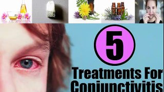 Pink Eye Treatment|Home Remedies to Get Rid from Pink Eyes Naturaly