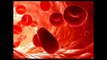 Анемия лечение. Как лечить анемию и повысить уровень гемоглобина