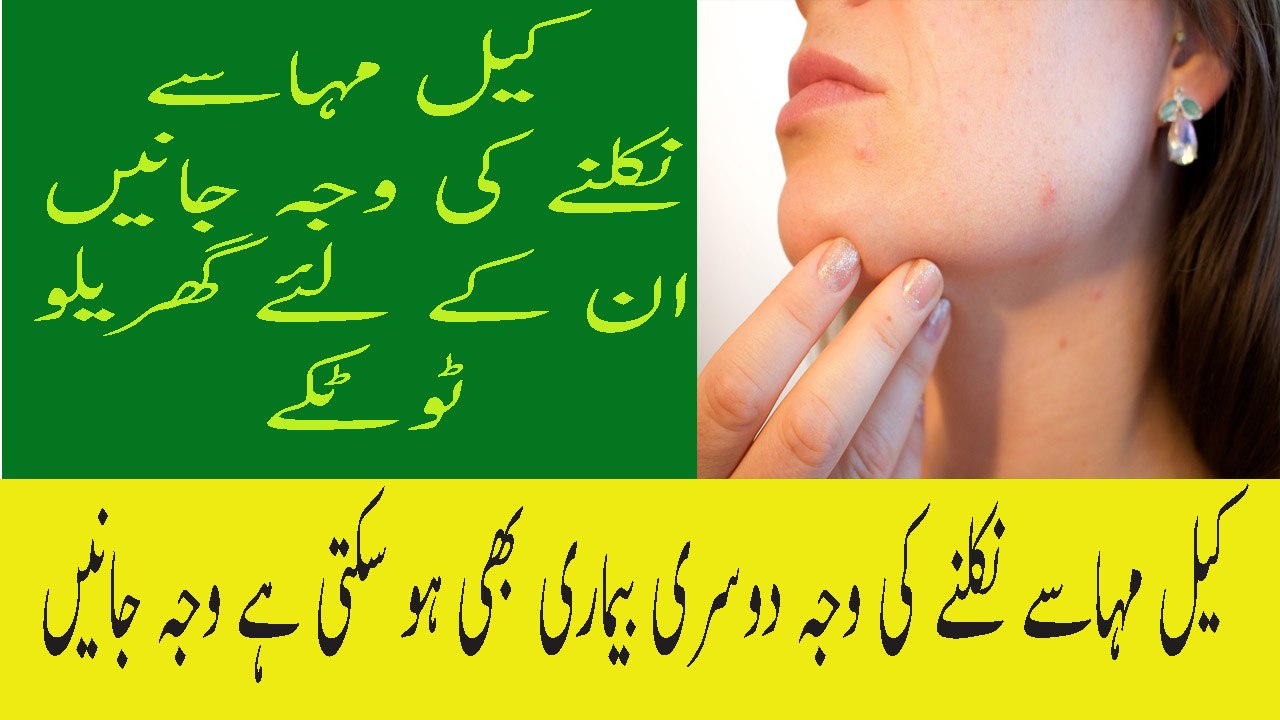 Keel Mahasay Ka Asan Totkey Pimple Kyu Hote Hain Chehre Ke Daag Dhabbe Hatane Ke Lye Totkey