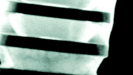 Cages à Semiconducteur : La Clé pour l'Avenir des Ordinateurs Quantique 🔬