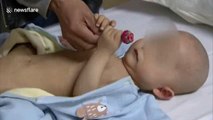 Chinese baby born with three legs recovering after surgery