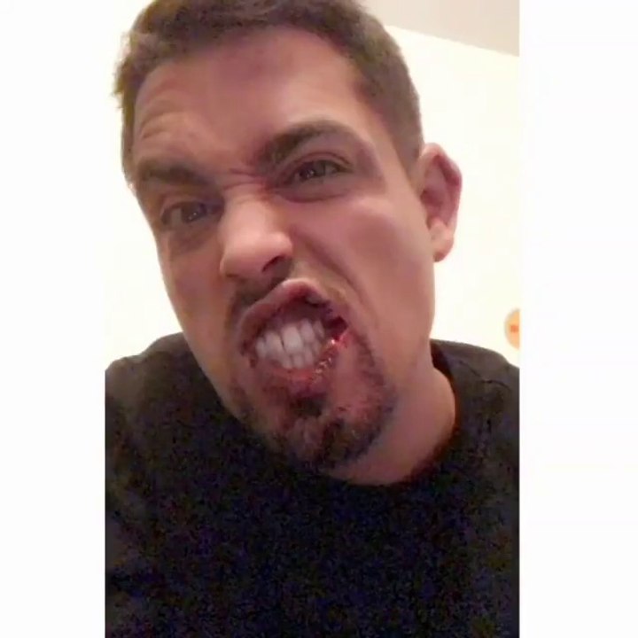 Le rappeur Lartiste violemment agressé en bas de chez lui.