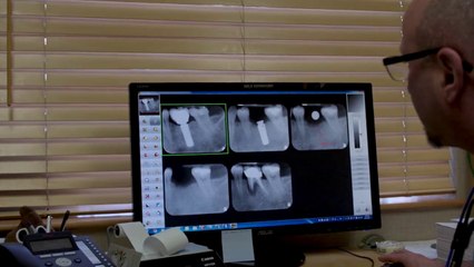 What Are Dental Implants?