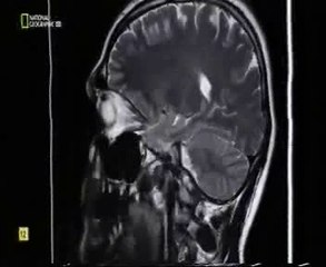 Cerebro inmortal: Mentes ciberneticas (Transferencia mental)