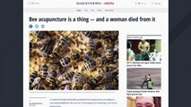 Woman Dies After Acupuncture Treatment Involving Live Bees