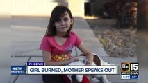 Mother speaks out after her daughter was severely burned