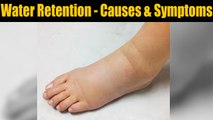 Water Retention - Causes and symptoms; Check out here | Boldsky