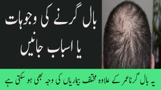 Bal Girne Ki Waja Hair Fall And Loss Reason In Urdu Baal Kyu Girte Hain