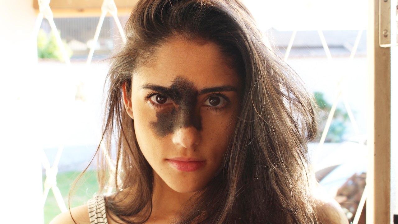 My Birthmark Makes Me Unique | SHAKE MY BEAUTY