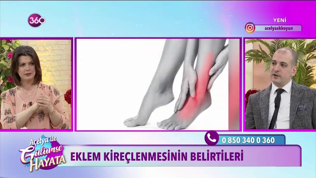Eklem kireçlenmesinin belirtileri nelerdir?