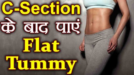 Weight Loss after Pregnancy | C-Section के बाद आसान तरीकों से पाएं Flat Tummy | Boldsky