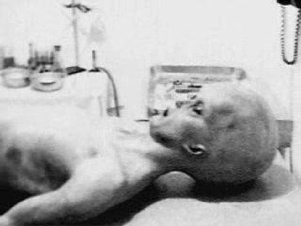 Alien Autopsy - Roswell UFO Crash