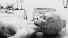 Alien Autopsy - Roswell UFO Crash