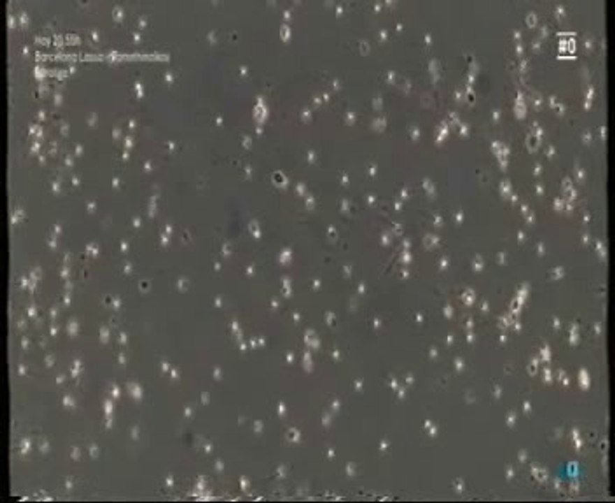 Fertilidad masculina: Factores de riesgo