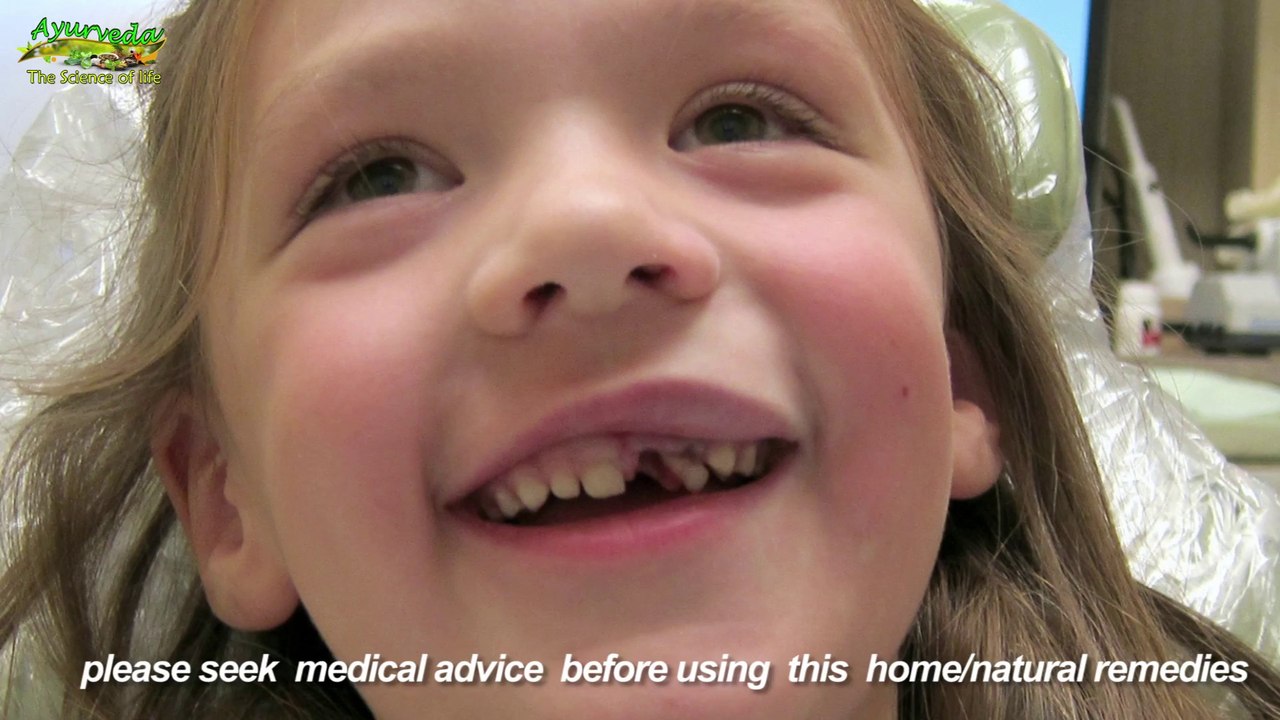 Easy Home Remedies for Toothache दांतों के दर्द का आसान घरेलू उपचार   Ayurveda Science Of Life