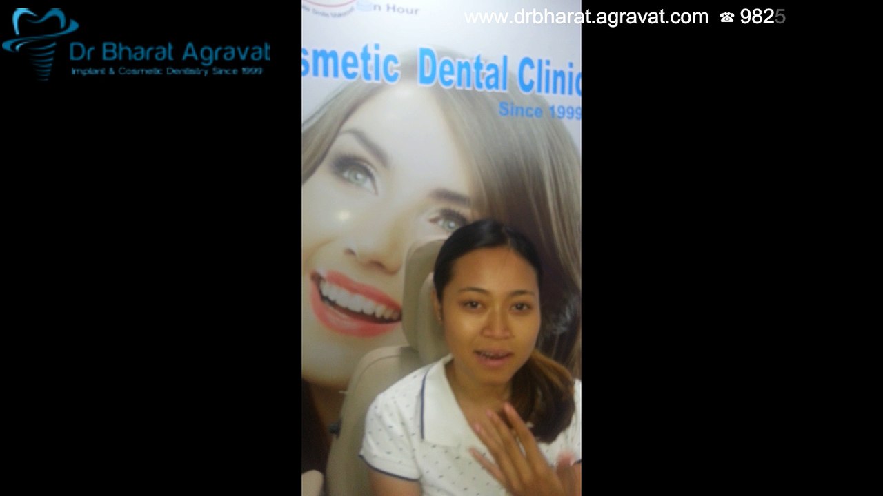 Invisible Clear Braces Reviews On Cost, Pros & Cons, Experience, Before & After in Ahmedabad Gujarat India