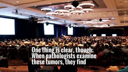 Doctors Said Immunotherapy Would Not Cure Her Cancer. They Were Wrong.