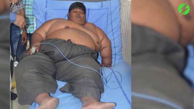 Cet ado obèse a perdu la moitié de son poids pour mettre fin au harcèlement dont il etait victime