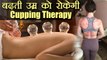 Cupping Therapy से लंबे समय तक दिख सकेंगे जवां | Amazing Benefits of Cupping Therapy | Boldsky