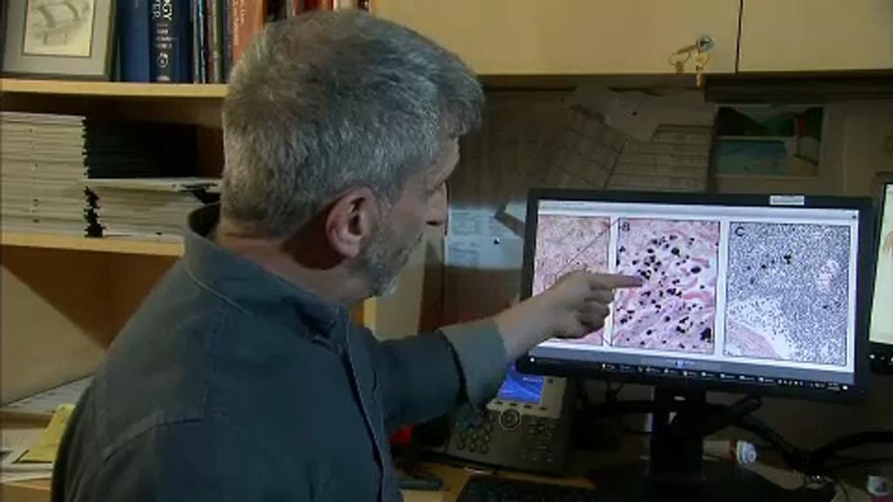 Hallott már az interstitiumról? Nem? Pedig ez lehet a legnagyobb szerve.