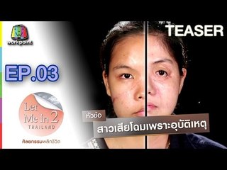 LET ME IN THAILAND SEASON2 | Ep.03 สาวเสียโฉมเพราะอุบัติเหตุ | 15 ต.ค. 59 TEASER