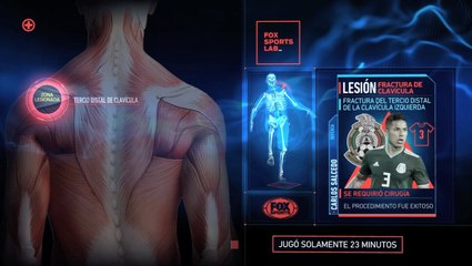 ¿Qué pasa con los lesionados del “Tri”?