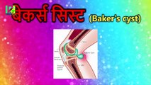 Best Treatment For Knee Pain   घुटने के दर्द के कारण और उपचार   Daily Health Care