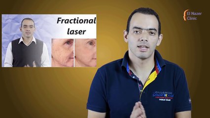 التقشير الكيميائي - د. محمد الناظر