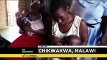Children in Malawi face severe acute malnutrition