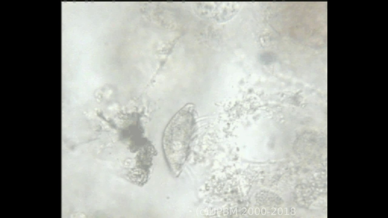Euplote