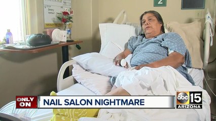 Valley woman gets major infection after nail salon visit