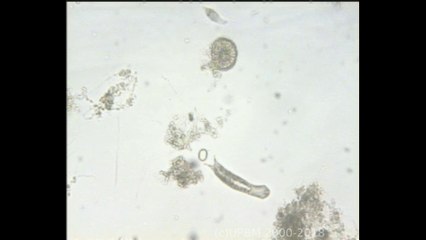 Divers microorganismes de la boue activée