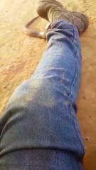 Snake Pulled out of Man's Pants