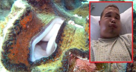 Amatör Dalgıç Cinsel Organını Devasa İstiridyeye Sokunca Hastanelik Oldu